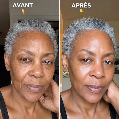 Votre visage manque d'éclat ?